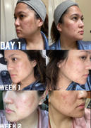 MEDICUBE US Zero Pore Serum Review