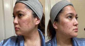 MEDICUBE US Zero Pore Serum Review