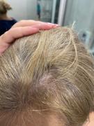 Bloom Hair Queen Hair by Plačková (balení na 15 dnů) Review