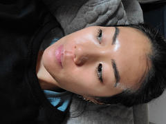 MEDICUBE US Zero Pore Pads 2.0 Review