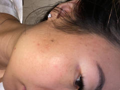 MEDICUBE US Zero Pore Pads 2.0 Review