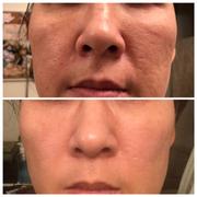 MEDICUBE US Zero Pore Pads 2.0 Review