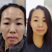 MEDICUBE US Super Cica Ampoule Review