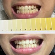 Holo Holo Teeth Whitening Kit Review