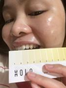 Holo Holo Teeth Whitening Kit Review
