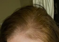 Kerotin Hair Growth Vitamins - 3 Month + Free Gift Review