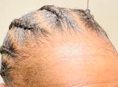 Kerotin Precision Hair Growth Serum Review
