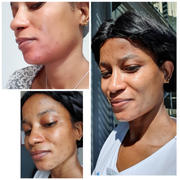 acne cleanse kallista