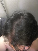 iRestore Hair Growth System Anti-Hair Loss Shampoo Review