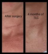 Woohoo Body + Happy Skincare 'TLC' Intensive Repair Oil Review