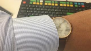MYKU MYKU White Marble Gold 38mm Watch Review