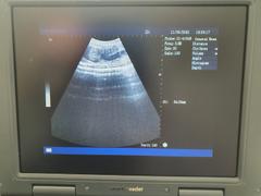 SmartBreeder Ultrasound Gel Review