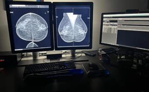 Monitors.com Barco Coronis MDCG-5221 5MP 21 Grayscale LED Mammo 3D-DBT Breast Imaging Display (K9301541A) Review
