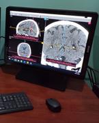 Monitors.com Barco Nio MDNC-3321 3MP 21 Color LED General Radiology Diagnostic PACS Display (K9300323A) Review
