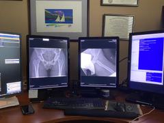 Monitors.com Barco Nio MDNC-3321 3MP 21 Color LED General Radiology Diagnostic PACS Display (K9300323A) Review