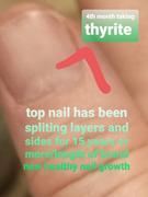 UMZU Thyrite - Thyroid Support & Metabolism Booster Review