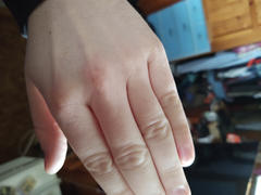 ProKera Skin Care ProKera Hand & Body Moisturizer, 16 oz. Review