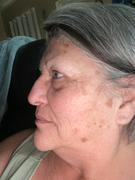 goPure Beauty Actives Intensive Spot Corrector Review