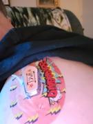 ExpressionMed Tree Sparkles Dexcom G6 Transmitter Sticker Review