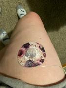 ExpressionMed Purple Bouquet Infusion Set Tape Review