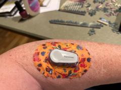 ExpressionMed Glitter Bomb Variety Pack Dexcom G6 Mini Tape Review
