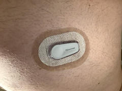 ExpressionMed White OmniPod UnderPatch Review