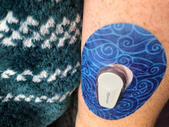 ExpressionMed Moody Marble Dexcom G6 Tape Review