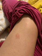 Food Over Drugs Eczema Formula Review