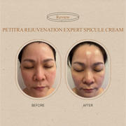 Unnie K-Shop Petitra Rejuvenation Expert Spicule Serum/Cream (2 x 10g) Review