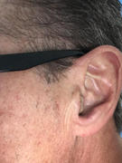 Audious Rechargeable & Invisible Hearing Aid Review