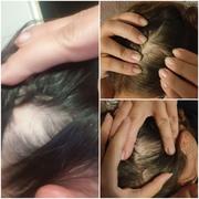 Bloom Hair Bloom Hair Gumijasti bonboni Samorog (1-mesečni paket) Review