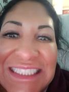 Ivory Smilez IvorySmilez Complete Teeth Whitening Kit Review