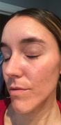 Dermay DERMA MASK™ - Smart & Portable Red Light Therapy Mask Review