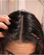Dermay PILOSONIC™ - Advanced Hair & Scalp Shower System Review