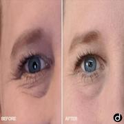 Dermay Eye Serum - Revitalize and Renew Eye Treatment Review