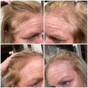 Goldie Locks® Hair Growth Supplements - Original Formula Review