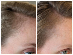 Goldie Locks® Hair Growth Supplements 3 Months - Original Review