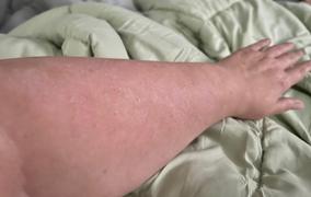 Abundant Natural Health (US) Overcoming Psoriasis Daily Routine Review