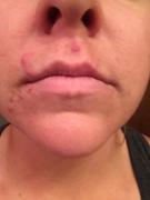 FATCO Skincare Products Cleansing Oil For Normal/Combo Skin 2 Oz Review