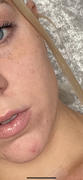 SKINKISSED™ The Clear Bundle Review
