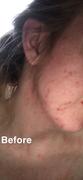 SKINKISSED™ Facial Cleanser Review