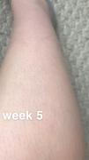 RoseSkinCo US Lumi - IPL Hair Removal Handset Review