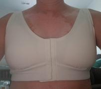 AnaOno  Rora Mastectomy Front Closure Bra Review