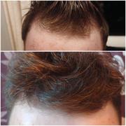 hair growth spray