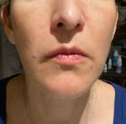 Red Centellaca Mask – MEDICUBE US