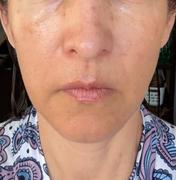 medicube glutathione glow serum 30g Miracle White Skin Whitening Products main image 0