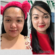 aprilskin.us Carrotene Trouble-Free Kit (with FREE Minis) Review