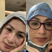 aprilskin.us Carrotene Trouble-Free Kit (with FREE Minis) Review
