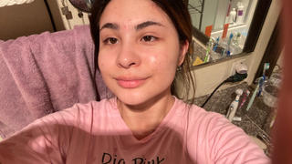 aprilskin.us Carrotene Trouble-Free Kit (with FREE Minis) Review