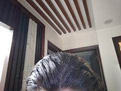 Re'equil Dandruff Treatment Bundle Review